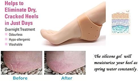 Silicone Gel Heel Knee Protector